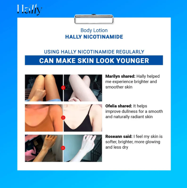 Original Hally Niacinamide Whitening Body Lotion
